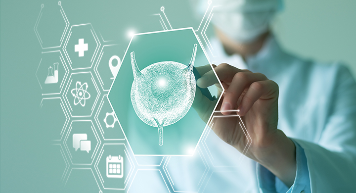 Top Risk Factors for Bladder Cancer You Should Know